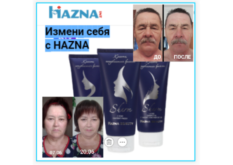 Лифтинг-система SHARM